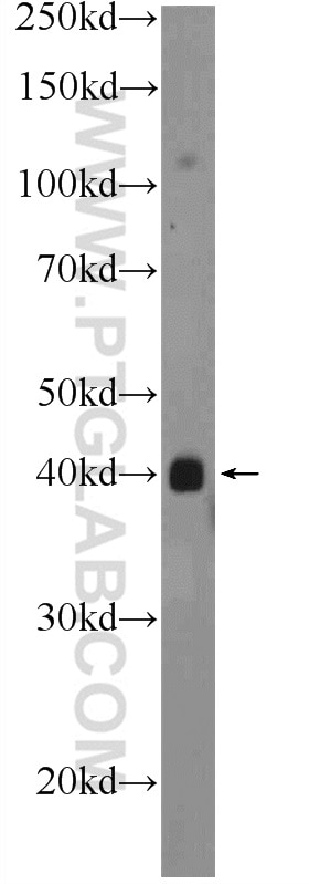 Western Blot (WB) analysis of A375 cells using PHC2 Polyclonal antibody (12867-1-AP)