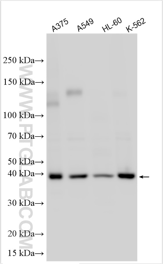 Western Blot (WB) analysis of various lysates using PHC2 Polyclonal antibody (12867-1-AP)