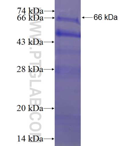 PHC2 fusion protein Ag3507 SDS-PAGE
