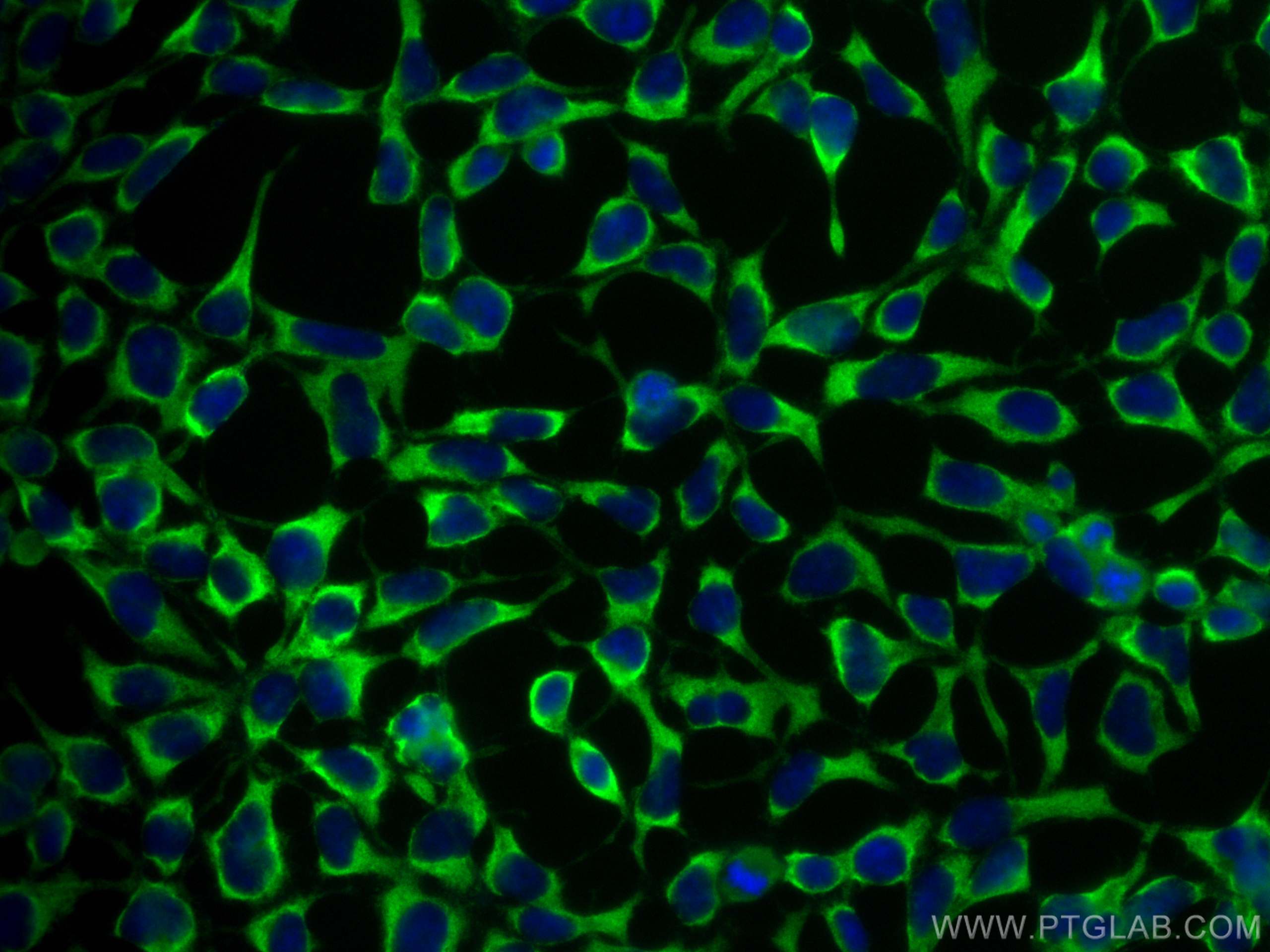 Immunofluorescence (IF) / fluorescent staining of HEK-293 cells using CoraLite® Plus 488-conjugated PHD2/EGLN1 Monoclona (CL488-66589)