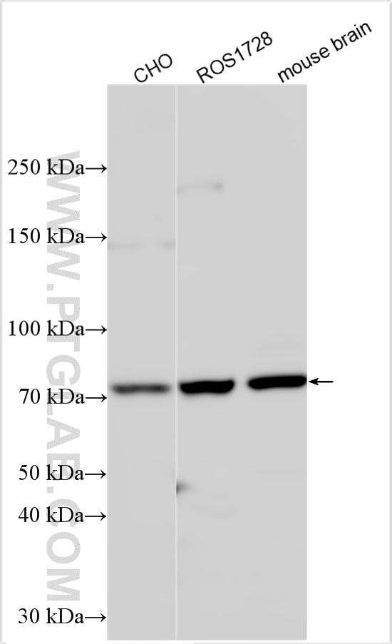 WB analysis using 30668-1-AP Western Blot (WB) analysis of various lysates using PHEX Polyclonal antibody (30668-1-AP)