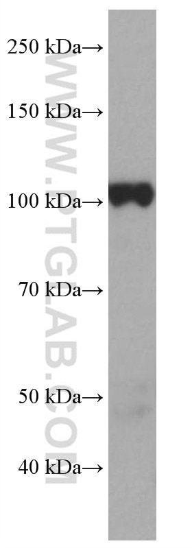 Western Blot (WB) analysis of rat lung tissue using PHEX Monoclonal antibody (66934-1-Ig)