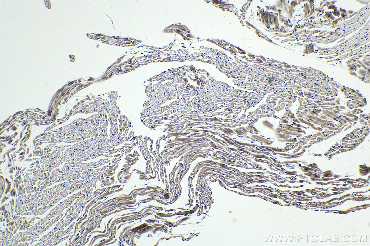 Immunohistochemistry (IHC) staining of mouse heart tissue using PHF1 Polyclonal antibody (15663-1-AP)