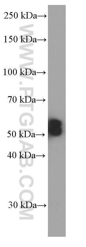 Western Blot (WB) analysis of fetal human brain tissue using PHF10 Monoclonal antibody (66341-1-Ig)