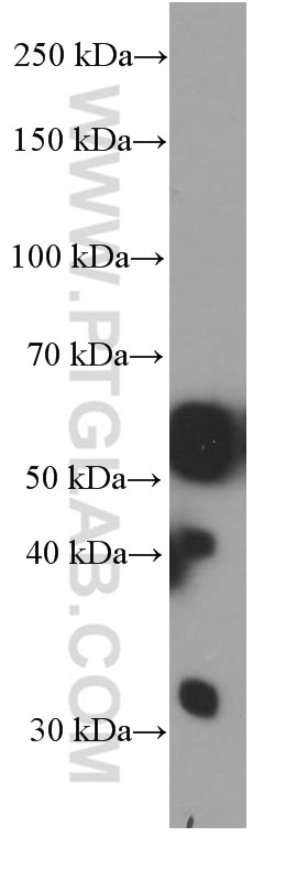 Western Blot (WB) analysis of fetal human brain tissue using PHF10 Monoclonal antibody (66341-1-Ig)