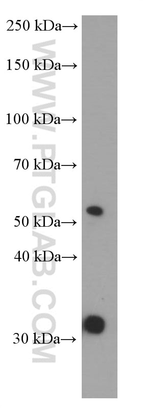 Western Blot (WB) analysis of Neuro-2a cells using PHF10 Monoclonal antibody (66341-1-Ig)