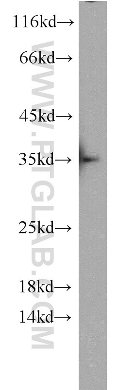 Western Blot (WB) analysis of mouse thymus tissue using PHF11 Polyclonal antibody (10898-1-AP)