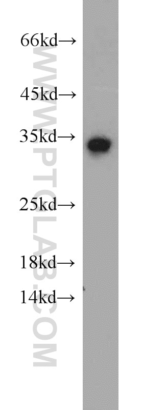Western Blot (WB) analysis of HeLa cells using PHF11 Polyclonal antibody (10898-1-AP)