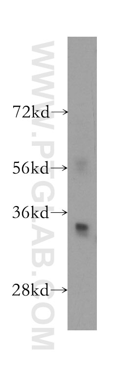 Western Blot (WB) analysis of HEK-293 cells using PHF11 Polyclonal antibody (10898-1-AP)