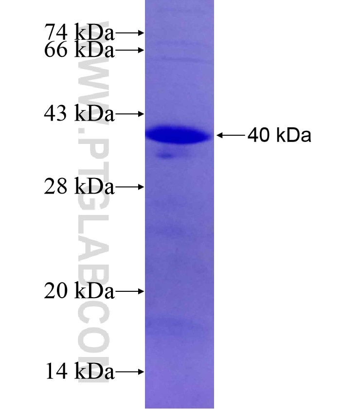 PHF11 fusion protein Ag18041 SDS-PAGE