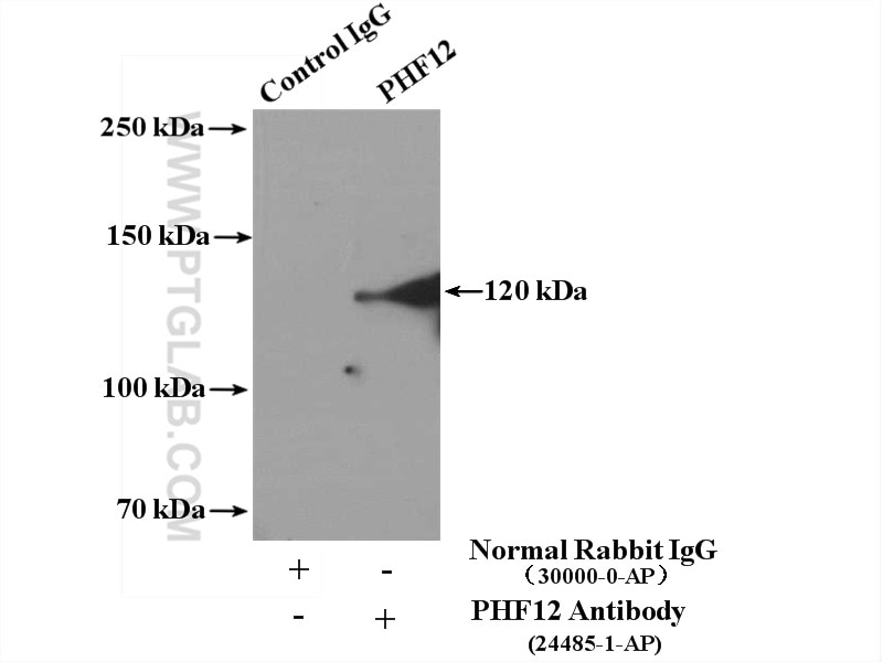 Immunoprecipitation (IP) experiment of mouse brain tissue using PHF12 Polyclonal antibody (24485-1-AP)