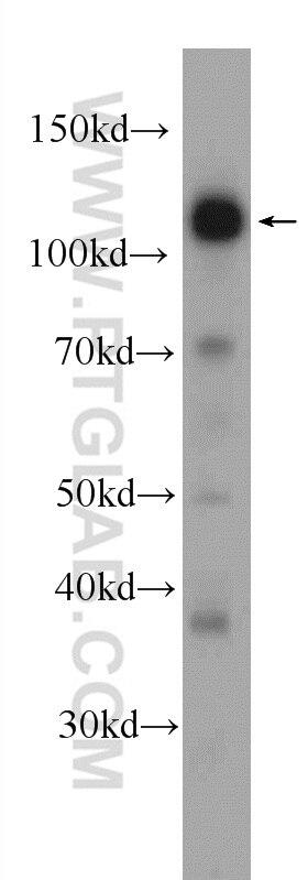 Western Blot (WB) analysis of mouse brain tissue using PHF12 Polyclonal antibody (24485-1-AP)