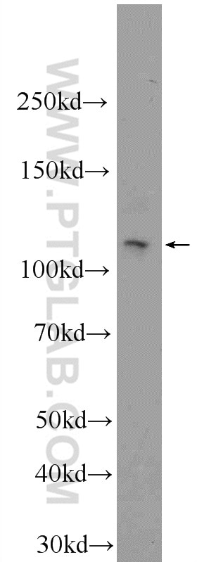 Western Blot (WB) analysis of mouse lung tissue using PHF12 Polyclonal antibody (24485-1-AP)