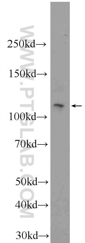 WB analysis of mouse lung using 24485-1-AP