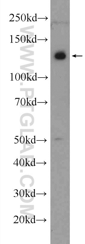 Western Blot (WB) analysis of mouse brain tissue using PHF12 Polyclonal antibody (24485-1-AP)