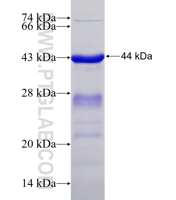 PHF12 fusion protein Ag18471 SDS-PAGE