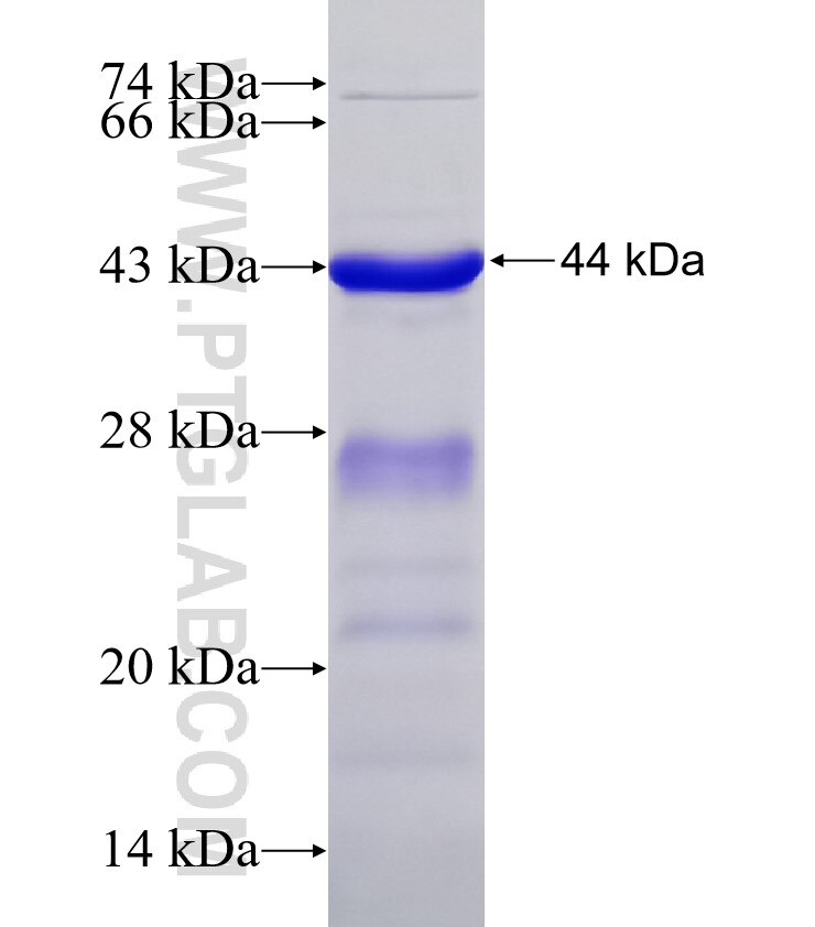 PHF12 fusion protein Ag18471 SDS-PAGE