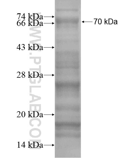 PHF12 fusion protein Ag20039 SDS-PAGE
