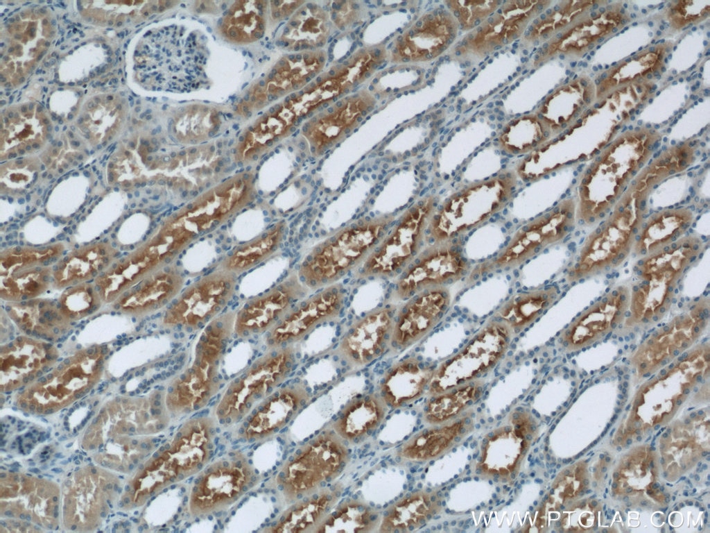Immunohistochemistry (IHC) staining of human kidney tissue using PHF14 Polyclonal antibody (24787-1-AP)