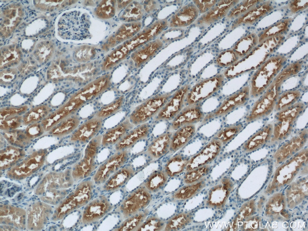 IHC staining of human kidney using 24787-1-AP