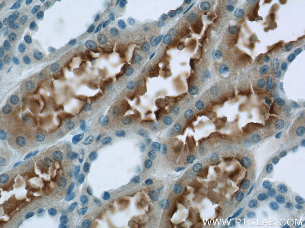Immunohistochemistry (IHC) staining of human kidney tissue using PHF14 Polyclonal antibody (24787-1-AP)