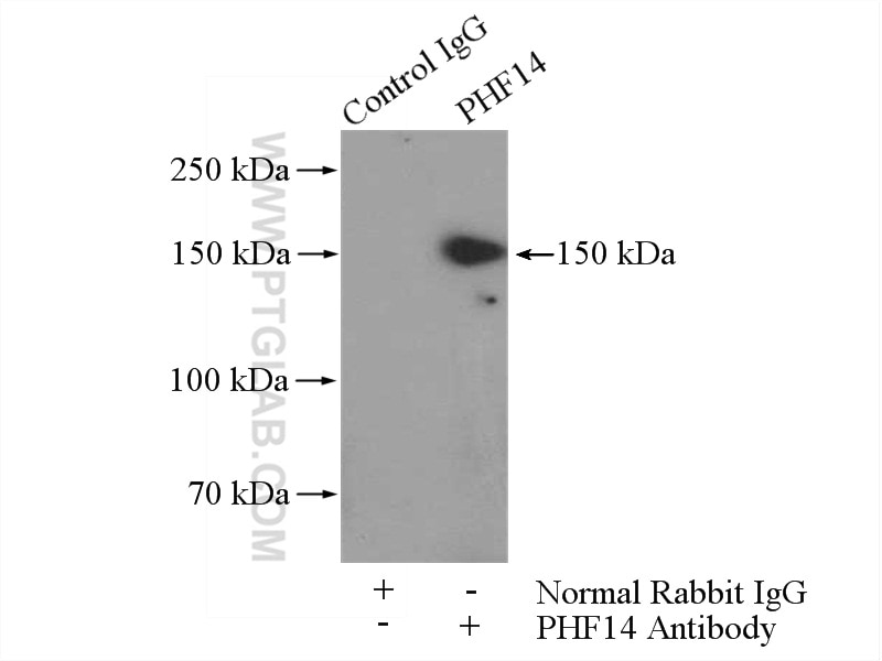 Immunoprecipitation (IP) experiment of HEK-293 cells using PHF14 Polyclonal antibody (24787-1-AP)