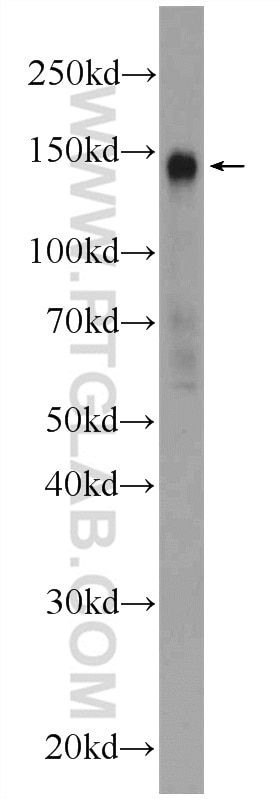 Western Blot (WB) analysis of HEK-293 cells using PHF14 Polyclonal antibody (24787-1-AP)