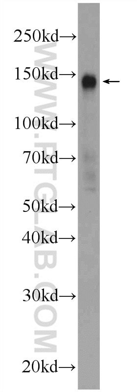 WB analysis of HEK-293 using 24787-1-AP