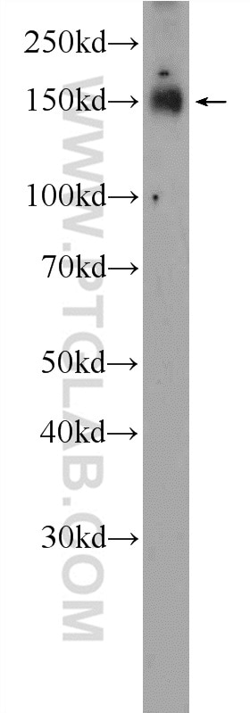Western Blot (WB) analysis of MDA-MB-453s cells using PHF14 Polyclonal antibody (24787-1-AP)