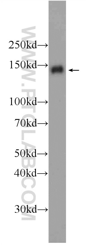 Western Blot (WB) analysis of HeLa cells using PHF14 Polyclonal antibody (24787-1-AP)