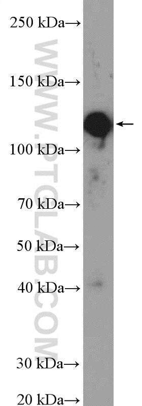 Western Blot (WB) analysis of MDCK cells using PHF15 Polyclonal antibody (11513-1-AP)