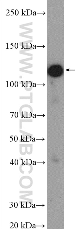 Western Blot (WB) analysis of MDCK cells using PHF15 Polyclonal antibody (11513-1-AP)
