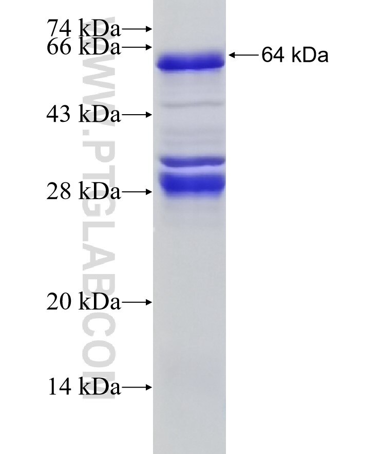 PHF15 fusion protein Ag2073 SDS-PAGE