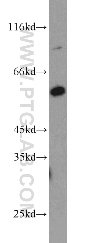 Western Blot (WB) analysis of HeLa cells using PHF17 Polyclonal antibody (15032-1-AP)