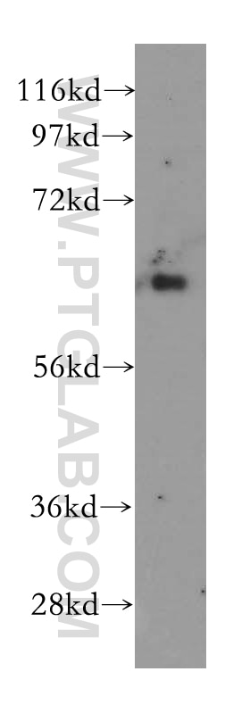 Western Blot (WB) analysis of HEK-293 cells using PHF17 Polyclonal antibody (15032-1-AP)