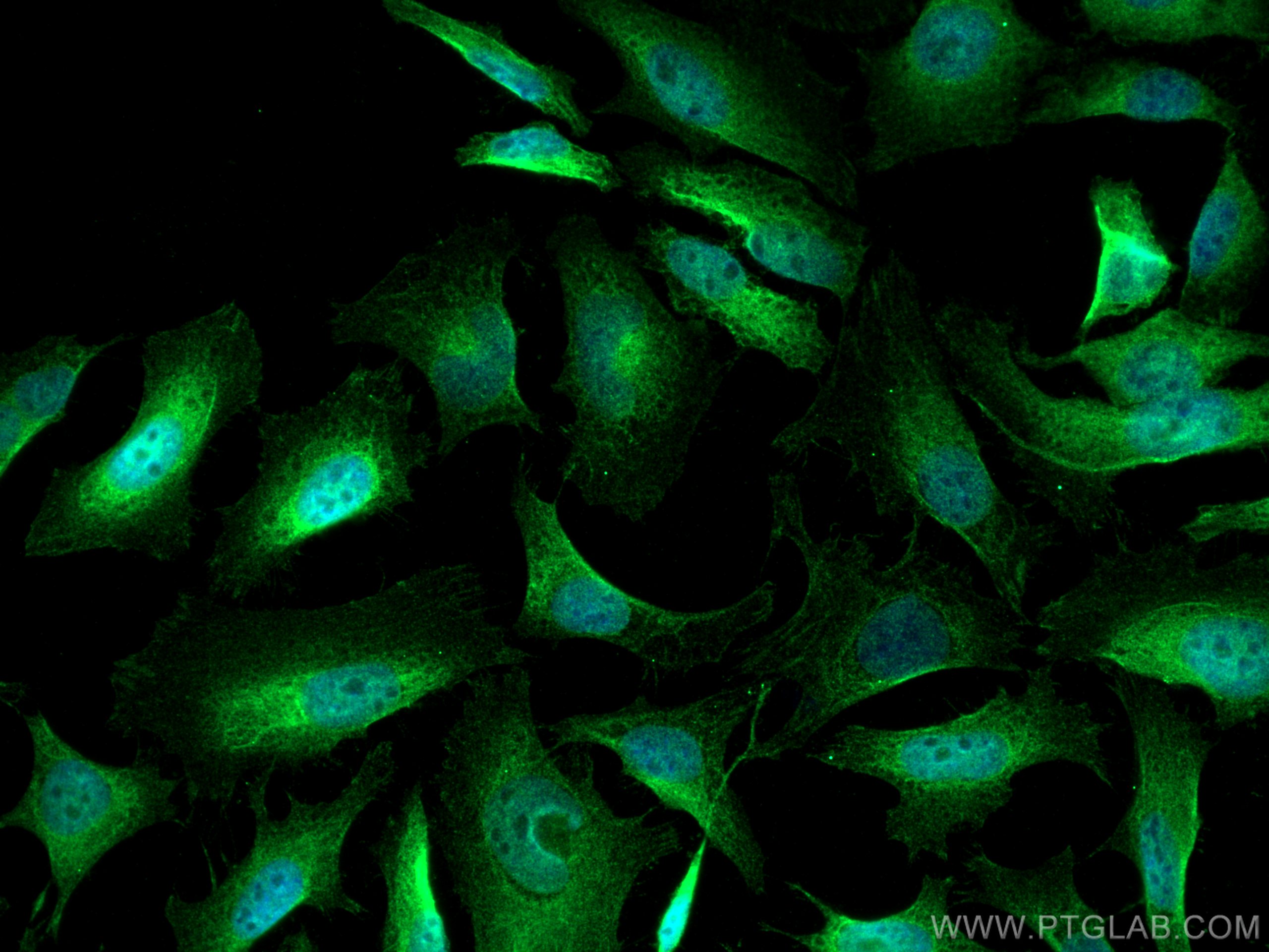 Immunofluorescence (IF) / fluorescent staining of HeLa cells using PHF17 Polyclonal antibody (28472-1-AP)