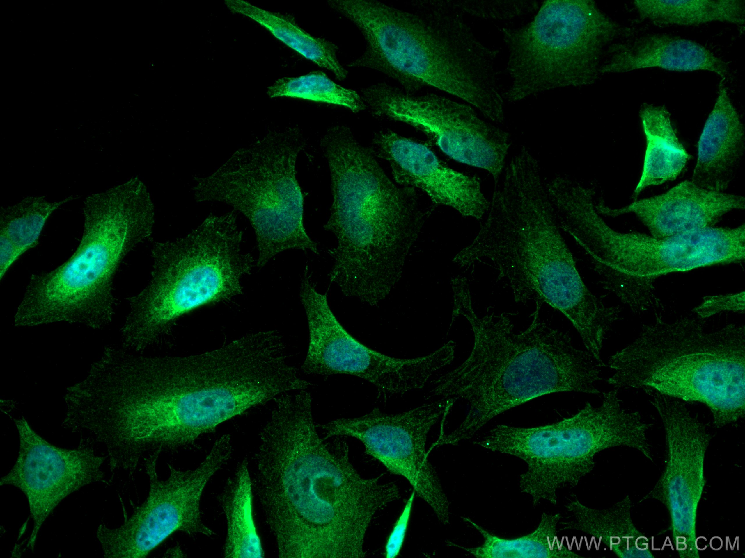 IF Staining of HeLa using 28472-1-AP