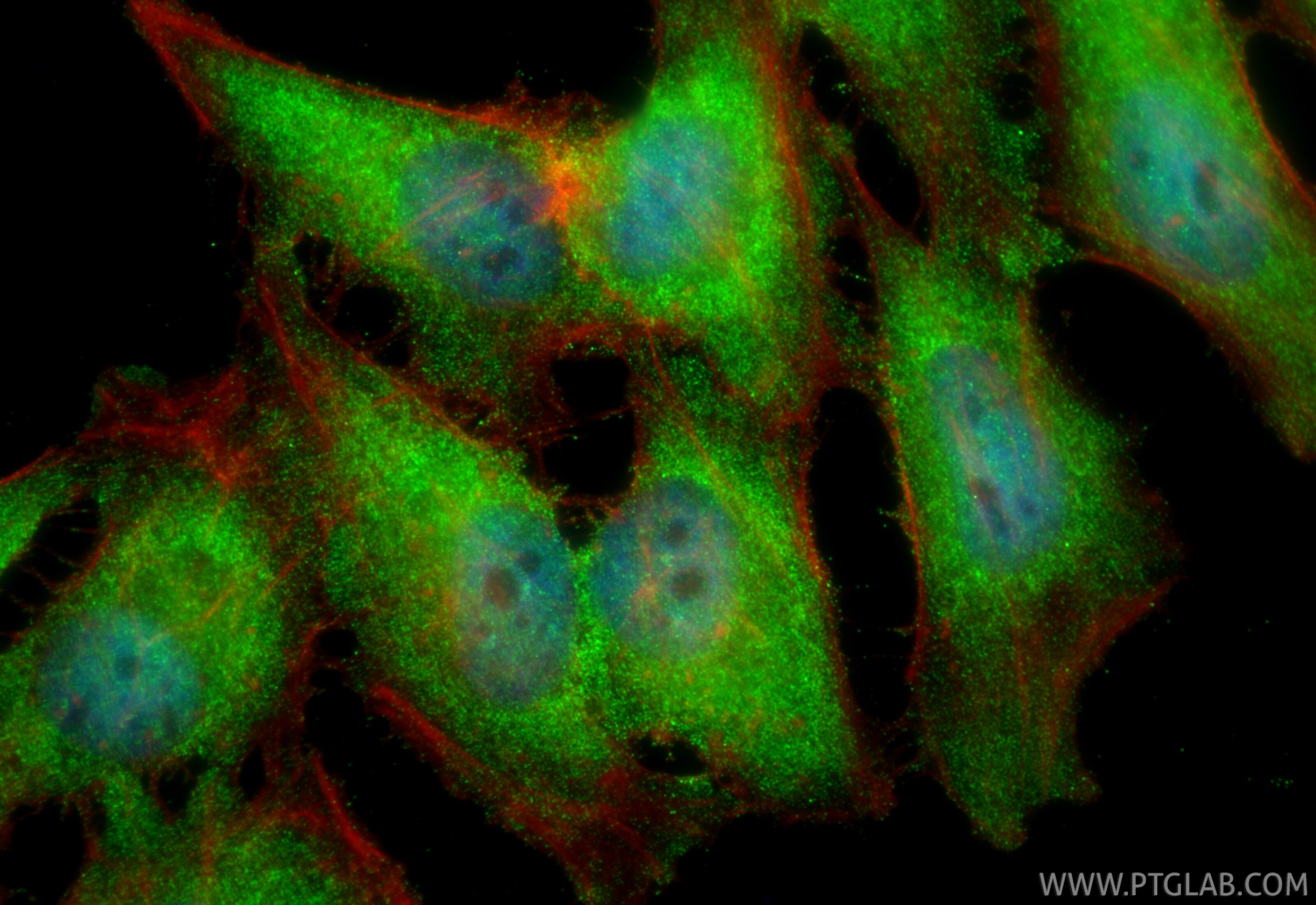 IF Staining of HeLa using 28472-1-AP (same clone as 28472-1-PBS) Immunofluorescence (IF) / fluorescent staining of HeLa cells using PHF17 Polyclonal antibody (28472-1-AP)