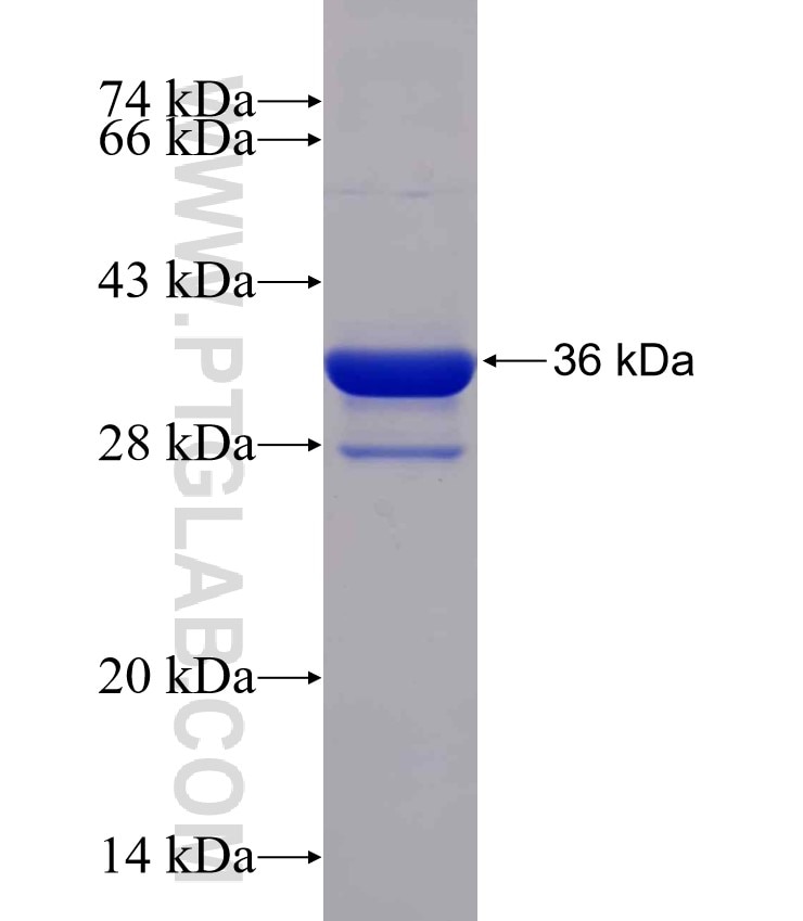PHF17 fusion protein Ag29675 SDS-PAGE