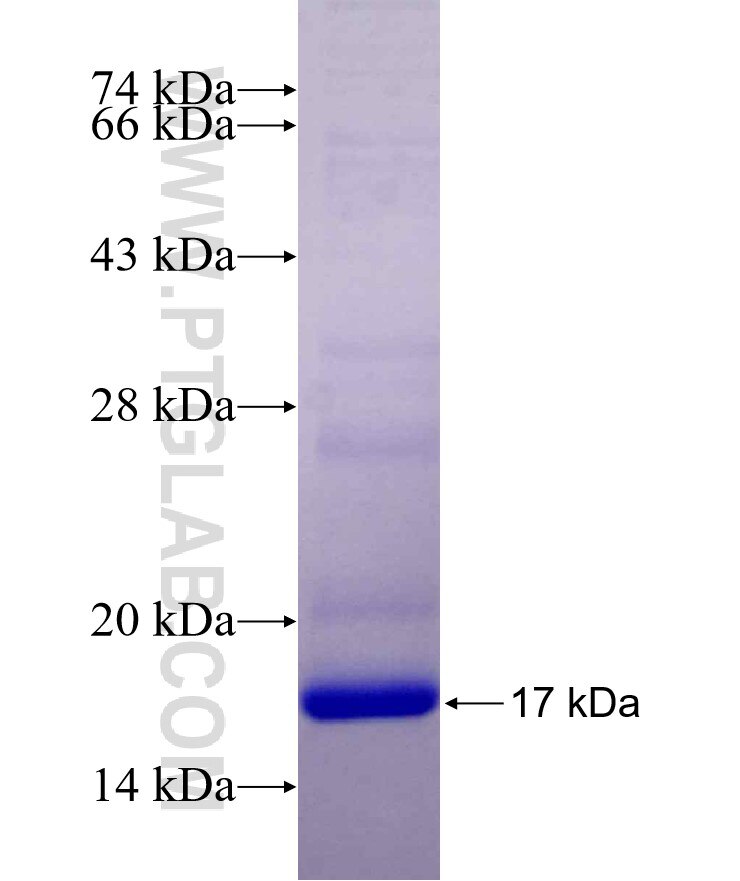PHF17 fusion protein Ag29699 SDS-PAGE