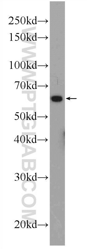 Western Blot (WB) analysis of rat brain tissue using PHF19 Polyclonal antibody (11895-1-AP)