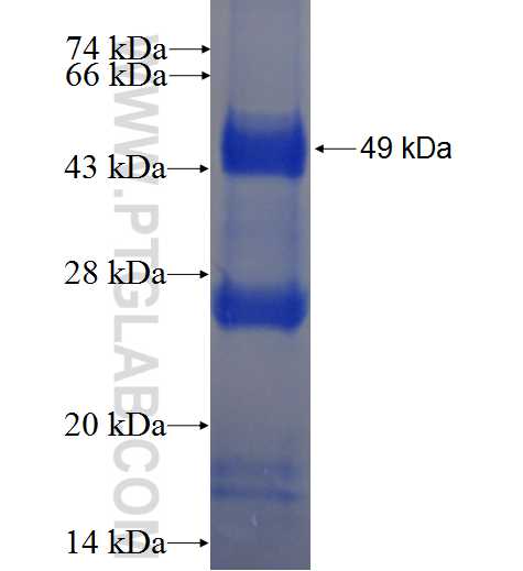 PHF19 fusion protein Ag2511 SDS-PAGE