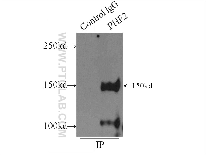 Immunoprecipitation (IP) experiment of HeLa cells using PHF2 Polyclonal antibody (24624-1-AP)