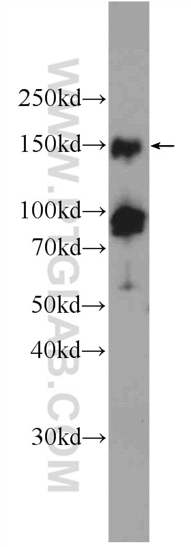 Western Blot (WB) analysis of Jurkat cells using PHF2 Polyclonal antibody (24624-1-AP)