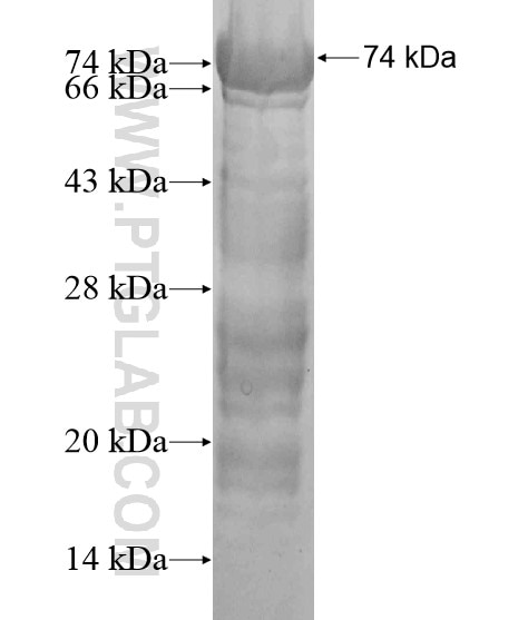 PHF2 fusion protein Ag20257 SDS-PAGE