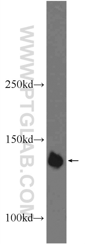 Western Blot (WB) analysis of HeLa cells using PHF20 Polyclonal antibody (22010-1-AP)