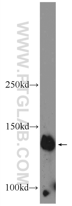 Western Blot (WB) analysis of Jurkat cells using PHF20 Polyclonal antibody (22010-1-AP)
