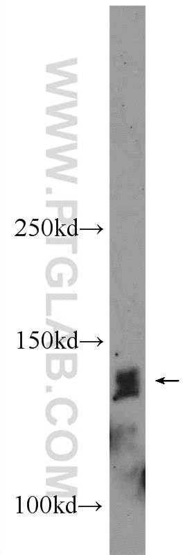 Western Blot (WB) analysis of mouse testis tissue using PHF20 Polyclonal antibody (22010-1-AP)