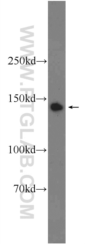 Western Blot (WB) analysis of Jurkat cells using PHF20 Polyclonal antibody (22010-1-AP)