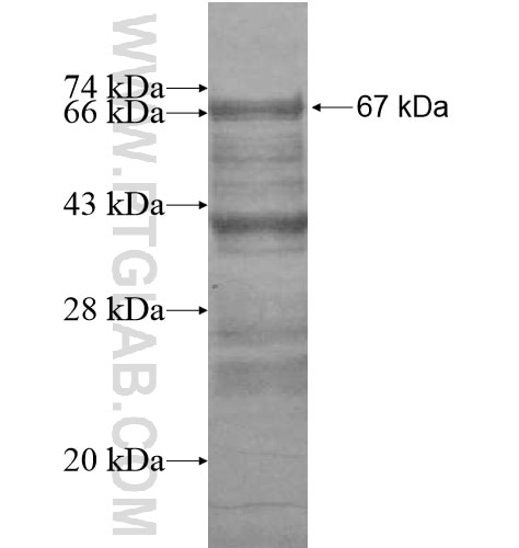 PHF20 fusion protein Ag15686 SDS-PAGE